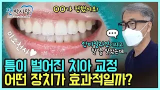 예쁜 미소를 위한 조건! 철사장치와 투명장치 중 선택은?