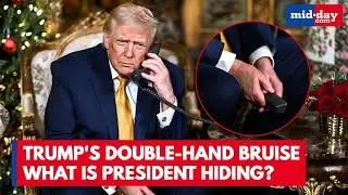 Trump&rsquo;s ROTTING Hands Exposed? Makeup & Bandages Fail to Hide Bruises | Days in Office Numbered?