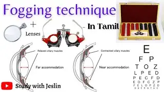 Fogging Test | Fogging technique in tamil | Fogging in optometry | Fogging method of refraction |