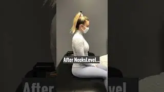 After a neck fracture...
