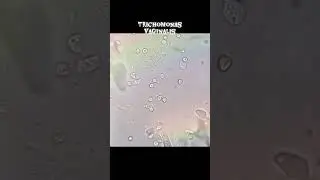 Trophozoite of trichomonas vaginalis #microscope #science #biology