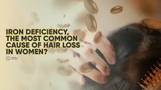 Iron Deficiency, The Most Common Cause of Hair Loss In Women? - Hair Talks by Terra Medical