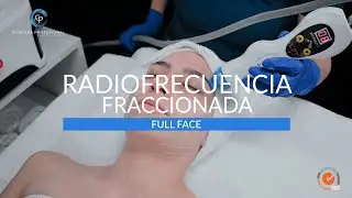 RADIOFRECUENCIA FRACCIONADA FULL FACE | EP EST&Eacute;TICA PROFESIONAL