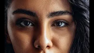 Eye asymmetry
