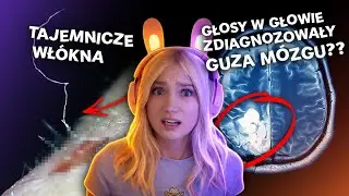 10. NIEROZWIĄZANYCH ZAGADEK MEDYCZNYCH