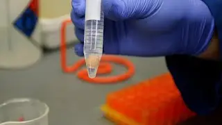 Brain Repair Research: The S. Thomas Carmichael Lab