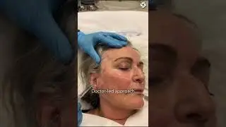 Youthful Temple Lift: A Transformative Treatment