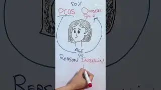 50% Women With PCOS Will Get Diabetes Before 40 &ndash; Don&rsquo;t Be One of Them! By FOCUZ