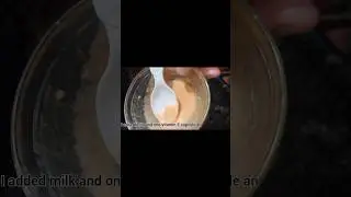 Winter Me Dry Skin Glow | Masoor Dal Face Pack DIY #skincarehaul #skincarefirst