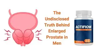 Actiflow Supplement Review | Weak Urine Flow? Do This For A Healthy Prostate