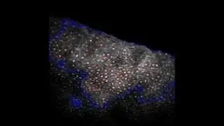 A Pulse Coupled Neural Network Segmentation Algorithm for Reflectance Confocal Images...