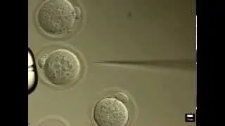CRISPR Cas9 Microinjection