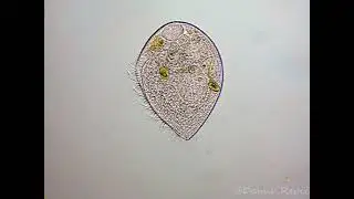 Blepharisma sp.
