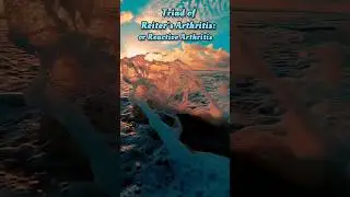 Reiter's Arthritis triad || Reactive Arthritis || Neet Pg mnemonics || neet pg 2024 || Medhacks