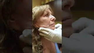 Skin Stress Test