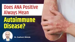 ANA Test Explained | What Does ANA Positive Mean? | Dr Sushant Shinde