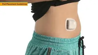 Omnipod DASH&reg; - How to Select a Pod Placement Site