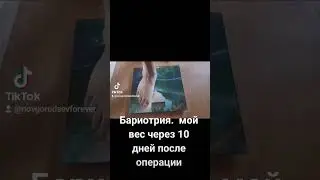 Бариотрия. мой вес через 10 дней после операции