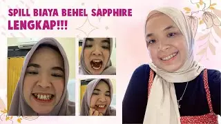 PENGALAMAN BEHEL & PROSES PEMASANGAN BEHEL SAPPHIRE | SPILL BIAYA | DENTAL UNIVERSE INDONESIA BY FDC
