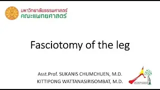 Double incision four compartment fasciotomy