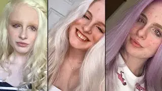 Albino woman becomes online sensation thanks to VIOLET-COLOURED EYES