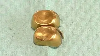 Золото в золотых зубах. Аффинаж 
