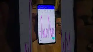 Project using ESP32 and Android Studio
