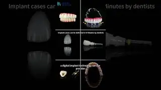 custom abutment with Zirconia crown screw retained.We are dentists' assistants.