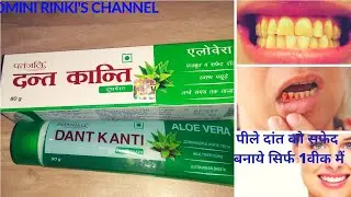 Patanjali Aloe vera Dant kanti Review Toothpaste पतंजलि दन्त कांति एलो वेरा टूथपेस्ट/पीली दांत ठीक