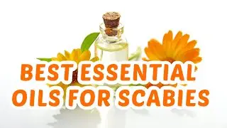 The Best Essential Oils For Killing Scabies