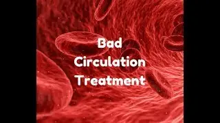 bad circulation treatment