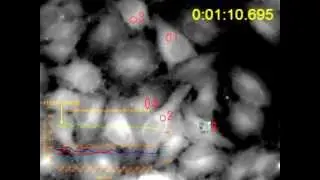 Calcium imaging in HeLa cells with CaTM-2 AM (Calcium ion Oscillation)
