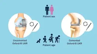 Revision Fw Cemented & Uncemented Oxford-III Primary Medial Unicompartmental Knee Replacements
