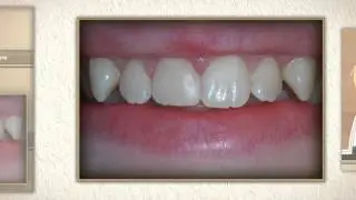 Smiles Renewed in Slidell - Oak Harbor Family Dentistry in Slidell, LA