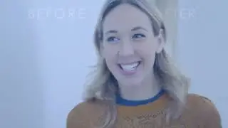 Commercial Video - TruSmile Veneers