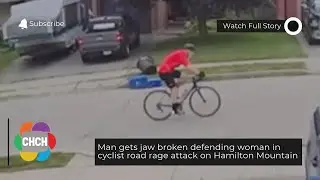 Man gets jaw broken defending woman in cyclist road rage attack on Hamilton Mountain