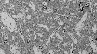 BPF Rabbit Brain ASC