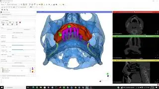 How to segment mucosa of edentulous maxilla & automatically align it to the scan model in 3D Slicer?