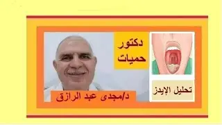 تحليل الإيدز وقرح الفم بودكاست