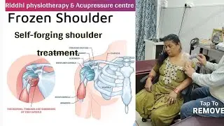 Frozen Shoulder Treatment at Home | Shoulder Physiotherapy Tips #ytshorts
