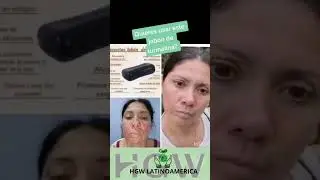 JABON DE TURMALINA HGW  #belleza #acne #turmalina #hgw