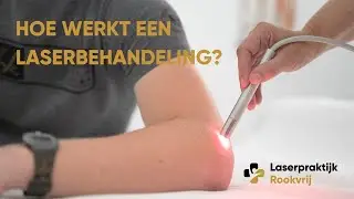 Hoe werkt een laserbehandeling van Laserpraktijk Rookvrij?