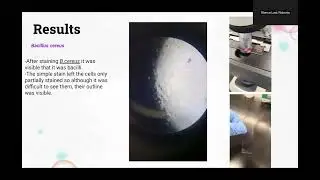 Group #1:  Eros Aranda, Roberto Blanco &ndash; Lab Report 4: Microscope & Simple Staining &ndash; Fall 2025
