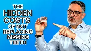 Missing Teeth and Facial Collapse: Why Implants Matter More Than You Think!