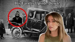 His Face Is Upside Down ! || The Man With The Upside Down Face