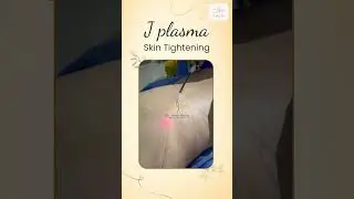 J Plasma Skin Tightening | Dr. Anshu Mishra #shorts #shortsfeed
