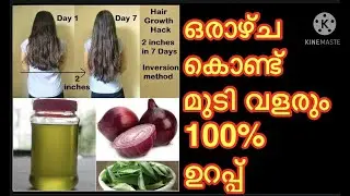 HAIR GROWTH OIL || Regrow Thinning Hair With This Natural Hair Oil- Onion Hair Oil Preparation