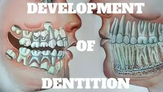 Ugly Duckling Stage | Leeway Space of Nance | Incisal Liability