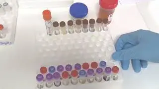 WATCH-How technicians explain the state of -the- art, satellite medical laboratory works at Lira RRH