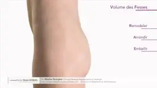 Augmentation volume des fesses Dr Nicolas Georgieu